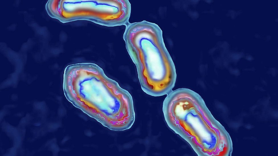 ALERTA EN RUSIA POR UN POSIBLE CASO DE PESTE NEUMÓNICA: QUÉ ES, CÓMO SE CONTAGIA Y QUÉ SE SABE